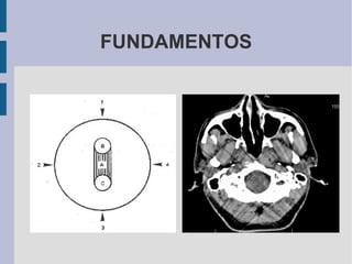 FUNDAMENTOS 