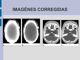 IMAGÉNES CORREGIDAS 