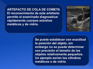 Se puede establecer con exactitud
la posición del objeto, sin
embargo no se puede determinar
con precisión el tamaño de los
objetos relativamente pequeños.
Un ejemplo serían los cilindros
metálicos o de vidrio
ARTEFACTO DE COLA DE COMETA
El reconocimiento de este artefacto
permite al examinado diagnosticar
rápidamente cuerpos extraños
metálicos y de vidrio.
 