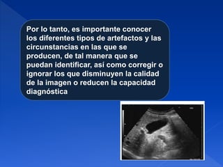 Por lo tanto, es importante conocer
los diferentes tipos de artefactos y las
circunstancias en las que se
producen, de tal manera que se
puedan identificar, así como corregir o
ignorar los que disminuyen la calidad
de la imagen o reducen la capacidad
diagnóstica
 
