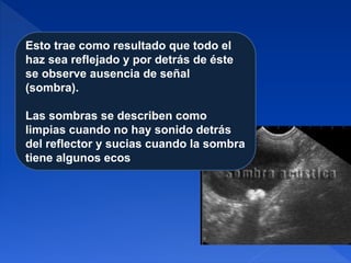 Esto trae como resultado que todo el
haz sea reflejado y por detrás de éste
se observe ausencia de señal
(sombra).
Las sombras se describen como
limpias cuando no hay sonido detrás
del reflector y sucias cuando la sombra
tiene algunos ecos
 