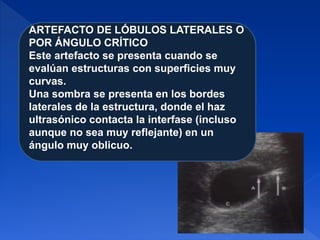 ARTEFACTO DE LÓBULOS LATERALES O
POR ÁNGULO CRÍTICO
Este artefacto se presenta cuando se
evalúan estructuras con superficies muy
curvas.
Una sombra se presenta en los bordes
laterales de la estructura, donde el haz
ultrasónico contacta la interfase (incluso
aunque no sea muy reflejante) en un
ángulo muy oblicuo.
 