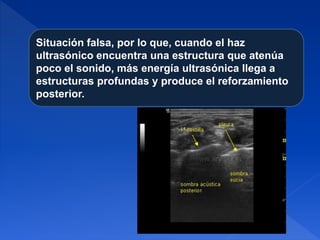 Situación falsa, por lo que, cuando el haz
ultrasónico encuentra una estructura que atenúa
poco el sonido, más energía ultrasónica llega a
estructuras profundas y produce el reforzamiento
posterior.
 