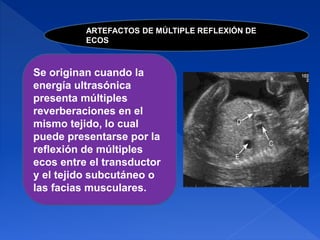 ARTEFACTOS DE MÚLTIPLE REFLEXIÓN DE
ECOS
Se originan cuando la
energía ultrasónica
presenta múltiples
reverberaciones en el
mismo tejido, lo cual
puede presentarse por la
reflexión de múltiples
ecos entre el transductor
y el tejido subcutáneo o
las facias musculares.
 