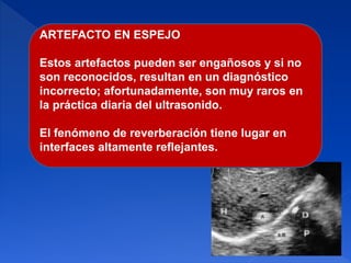 ARTEFACTO EN ESPEJO
Estos artefactos pueden ser engañosos y si no
son reconocidos, resultan en un diagnóstico
incorrecto; afortunadamente, son muy raros en
la práctica diaria del ultrasonido.
El fenómeno de reverberación tiene lugar en
interfaces altamente reflejantes.
 
