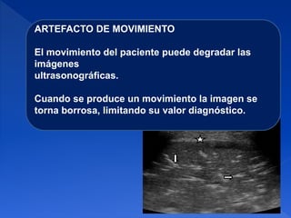 ARTEFACTO DE MOVIMIENTO
El movimiento del paciente puede degradar las
imágenes
ultrasonográficas.
Cuando se produce un movimiento la imagen se
torna borrosa, limitando su valor diagnóstico.
 