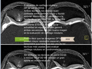 Evaluación de cartílago rotuliano
DP fat sat Vs DESS
Ambas tecnicas nos ofrecen buen
contraste entre cartilago,hueso y liquido
sinovial. Mientras la DP pertenece a la
familia de secuencias TSE, la secuencia
DESS es una ecogradiente de tipo
coherente STEADY STATE. En la
actualidad en equipos de alta gamma
ambas secuencias nos dan buena imagen
en la evaluación de cartílago rotuliano.
Podría decir que las imagenes DP fat sat
poseen mayor resolución espacial y
temporal lo que hace que sea una de las
técnicas más usadas para evaluar
cartilago rotuliano en condromalacia.
Sin embargo las técnicas 3D como DESS
o incluso TRUFI3D WE brindan un gran
aporte en esta evaluación.
 