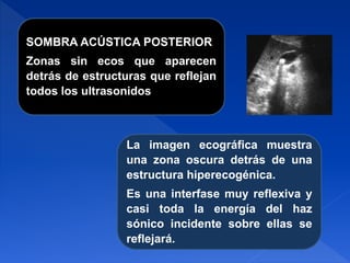 La imagen ecográfica muestra
una zona oscura detrás de una
estructura hiperecogénica.
Es una interfase muy reflexiva y
casi toda la energía del haz
sónico incidente sobre ellas se
reflejará.
SOMBRA ACÚSTICA POSTERIOR
Zonas sin ecos que aparecen
detrás de estructuras que reflejan
todos los ultrasonidos
 