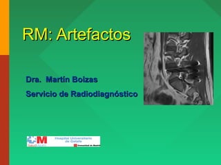 RM: ArtefactosRM: Artefactos
Dra. Martín BoizasDra. Martín Boizas
Servicio de RadiodiagnósticoServicio de Radiodiagnóstico
 
