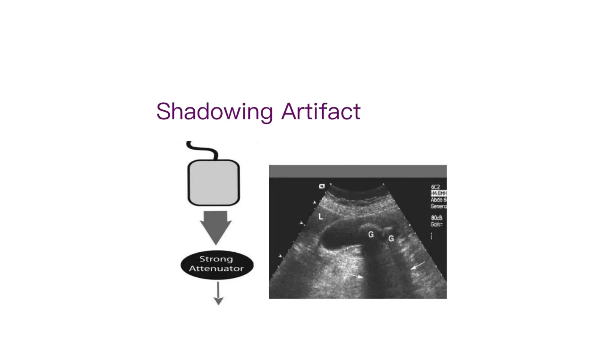 Artefacts In Ultrasound Imaging Physics Pptx