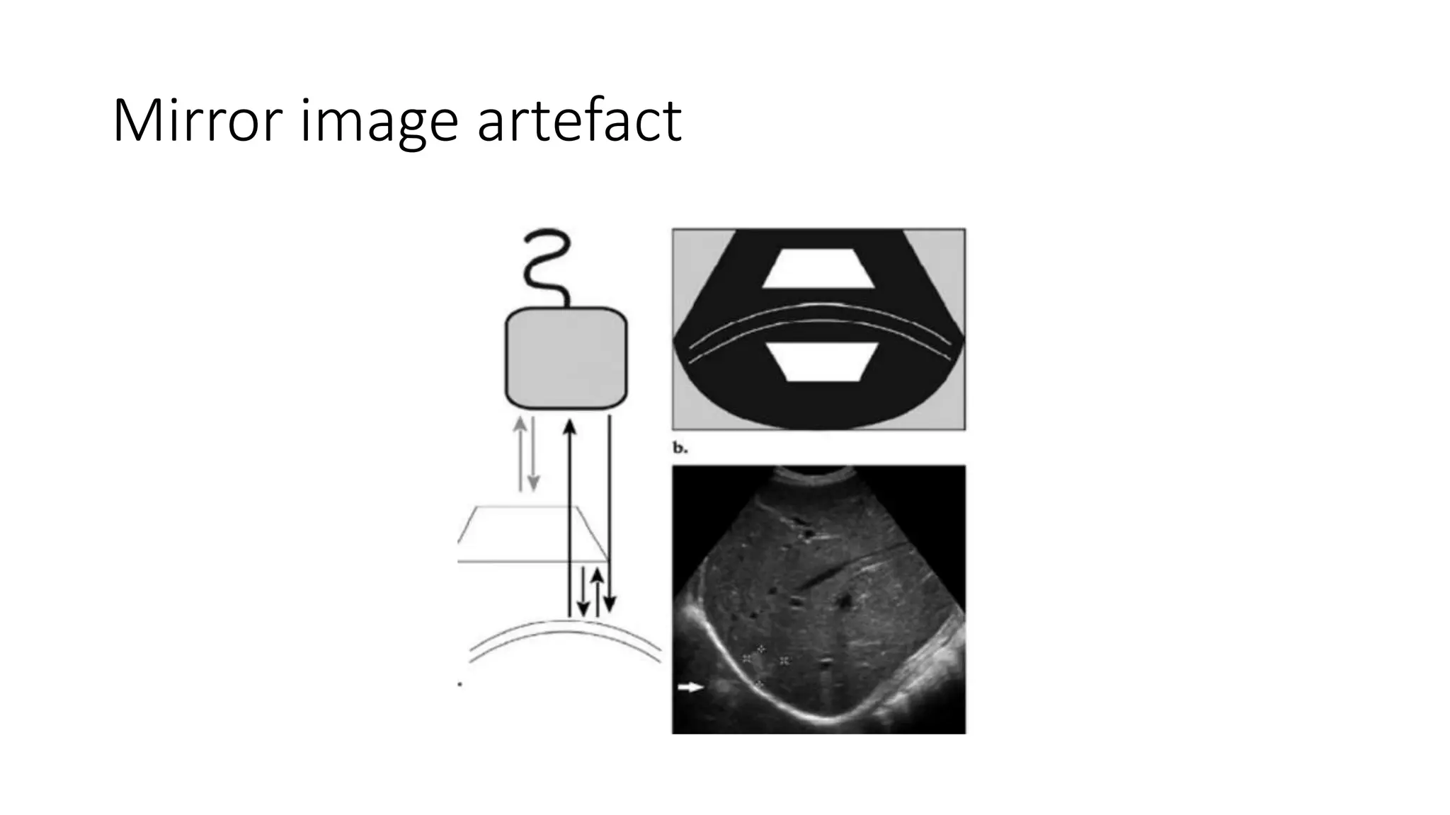 Artefacts In Ultrasound Imaging Physics Pptx
