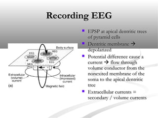 Artifacts in EEG - Recognition and differentiation | PPT