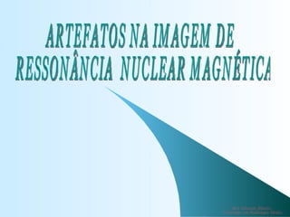 ARTEFATOS NA IMAGEM DE RESSONÂNCIA  NUCLEAR MAGNÉTICA Alex Eduardo Ribeiro  Tecnólogo em Radiologia Médica 