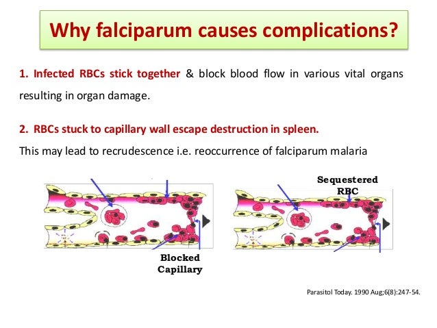 Artemisinin based combination therapy