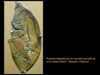 Humano atacado por un oso del que sólo se ve la zarpa (Saint – Germain, Francia)  