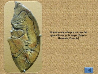 Humano atacado por un oso del
que sólo se ve la zarpa (Saint –
Germain, Francia)
 