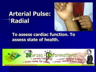 Arterial Pulse:  Radial  To assess cardiac function. To assess state of health.   