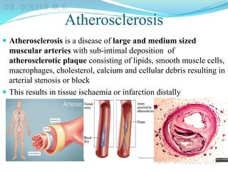 Atherosclerosis
 Atherosclerosis is a disease of large and medium sized
muscular arteries with sub-intimal deposition of
atherosclerotic plaque consisting of lipids, smooth muscle cells,
macrophages, cholesterol, calcium and cellular debris resulting in
arterial stenosis or block
 This results in tissue ischaemia or infarction distally
 