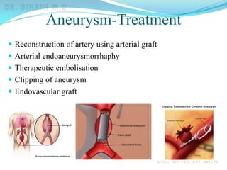 Aneurysm-Treatment
 Reconstruction of artery using arterial graft
 Arterial endoaneurysmorrhaphy
 Therapeutic embolisation
 Clipping of aneurysm
 Endovascular graft
 
