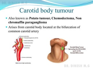 Carotid body tumour
 Also known as Potato tumour, Chemodectoma, Non
chromaffin paraganglioma
 Arises from carotid body located at the bifurcation of
common carotid artery
 