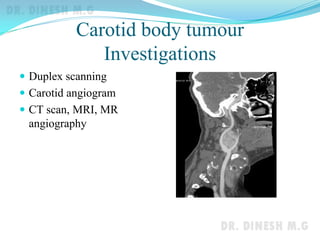 Carotid body tumour
Investigations
 Duplex scanning
 Carotid angiogram
 CT scan, MRI, MR
angiography
 