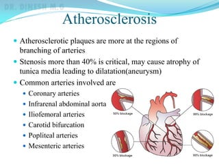 Atherosclerosis
 Atherosclerotic plaques are more at the regions of
branching of arteries
 Stenosis more than 40% is critical, may cause atrophy of
tunica media leading to dilatation(aneurysm)
 Common arteries involved are
 Coronary arteries
 Infrarenal abdominal aorta
 Iliofemoral arteries
 Carotid bifurcation
 Popliteal arteries
 Mesenteric arteries
 
