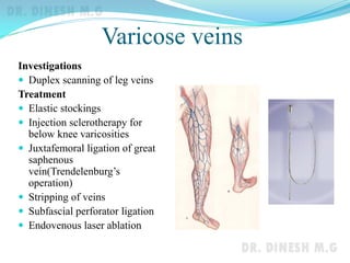 Varicose veins
Investigations
 Duplex scanning of leg veins
Treatment
 Elastic stockings
 Injection sclerotherapy for
below knee varicosities
 Juxtafemoral ligation of great
saphenous
vein(Trendelenburg’s
operation)
 Stripping of veins
 Subfascial perforator ligation
 Endovenous laser ablation
 