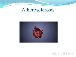 Atherosclerosis
 