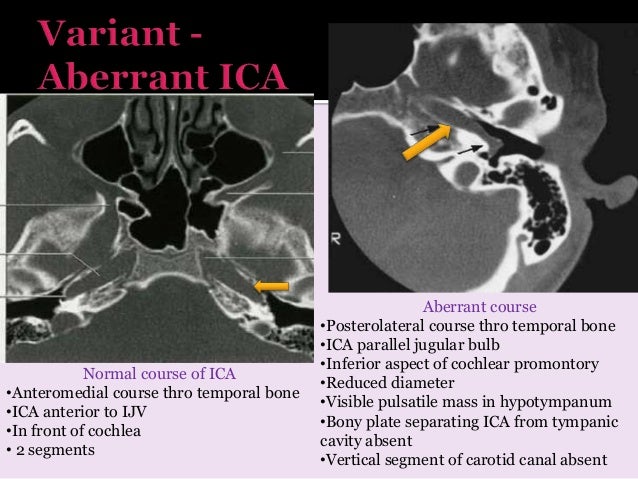 radiology Arterial and venous supply of brain neuroimaging part 1