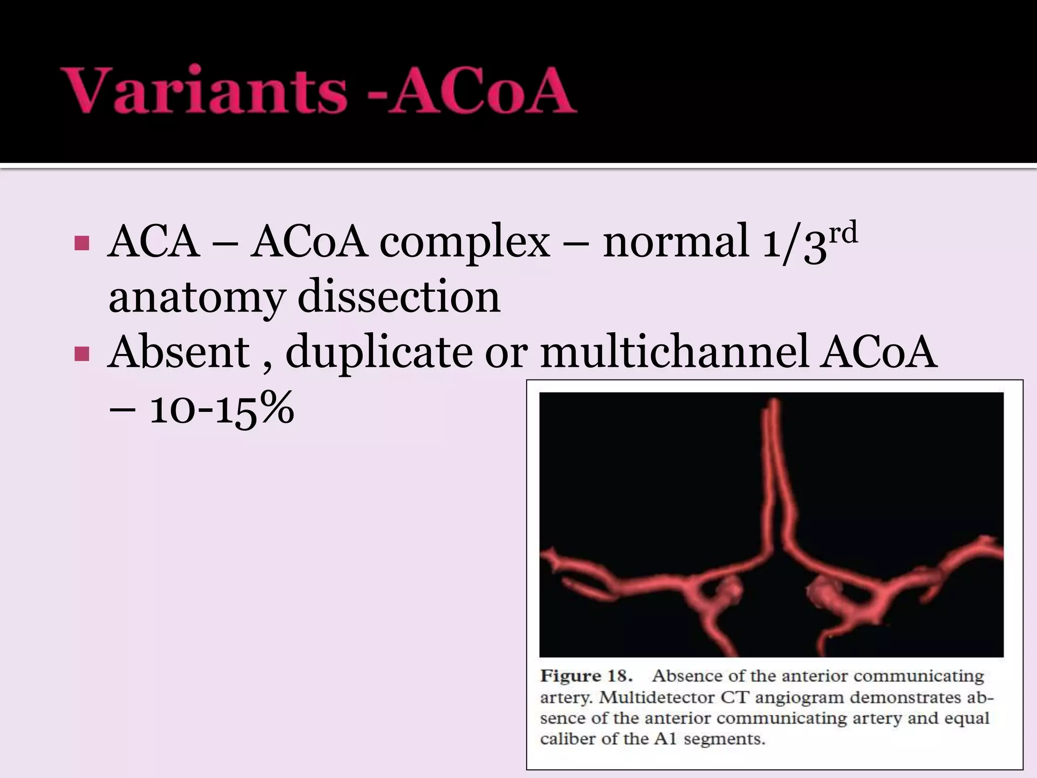  ACA – ACoA complex – normal 1/3rd
anatomy dissection
 Absent , duplicate or multichannel ACoA
– 10-15%
 