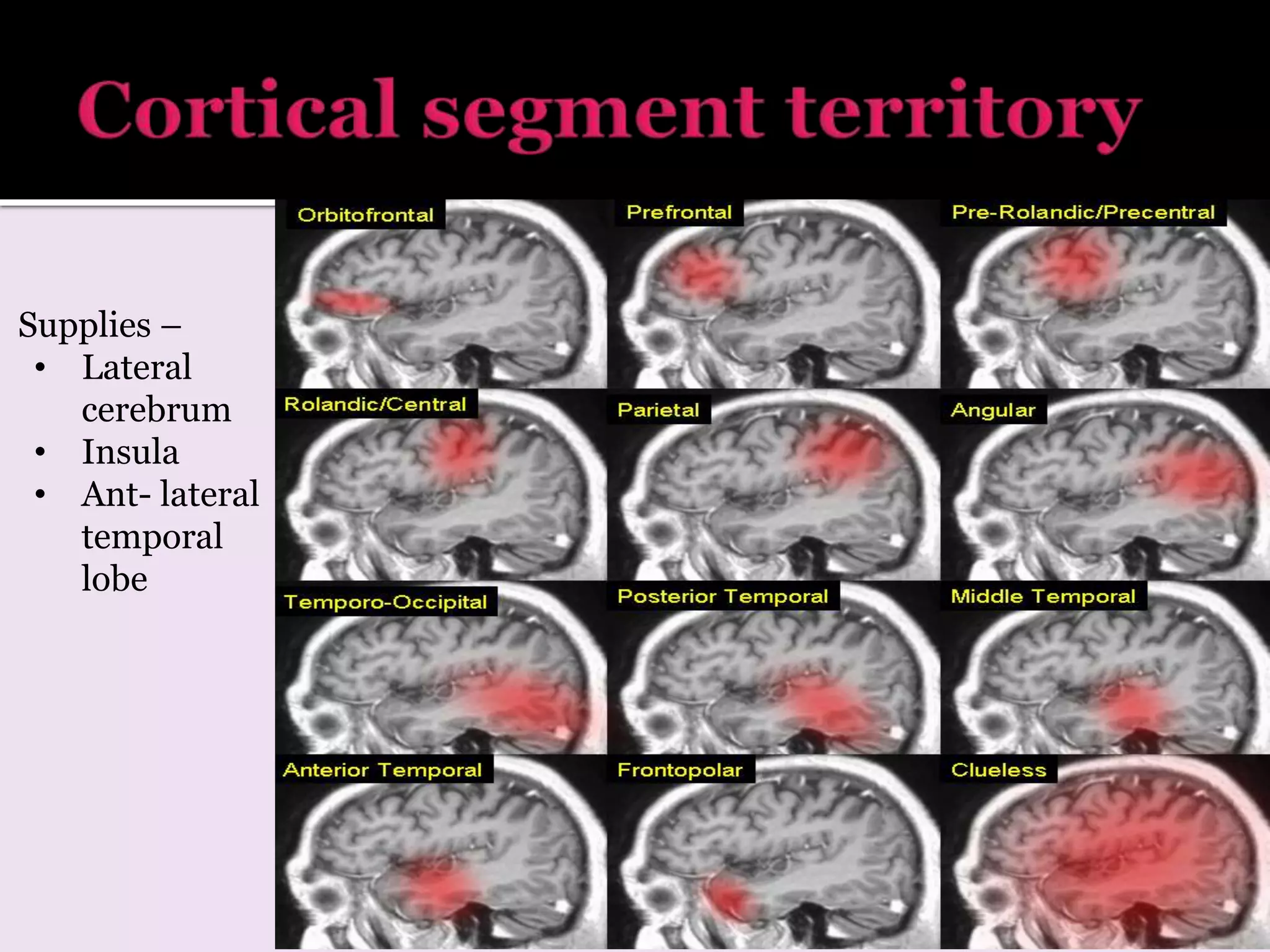 Supplies –
• Lateral
cerebrum
• Insula
• Ant- lateral
temporal
lobe
 