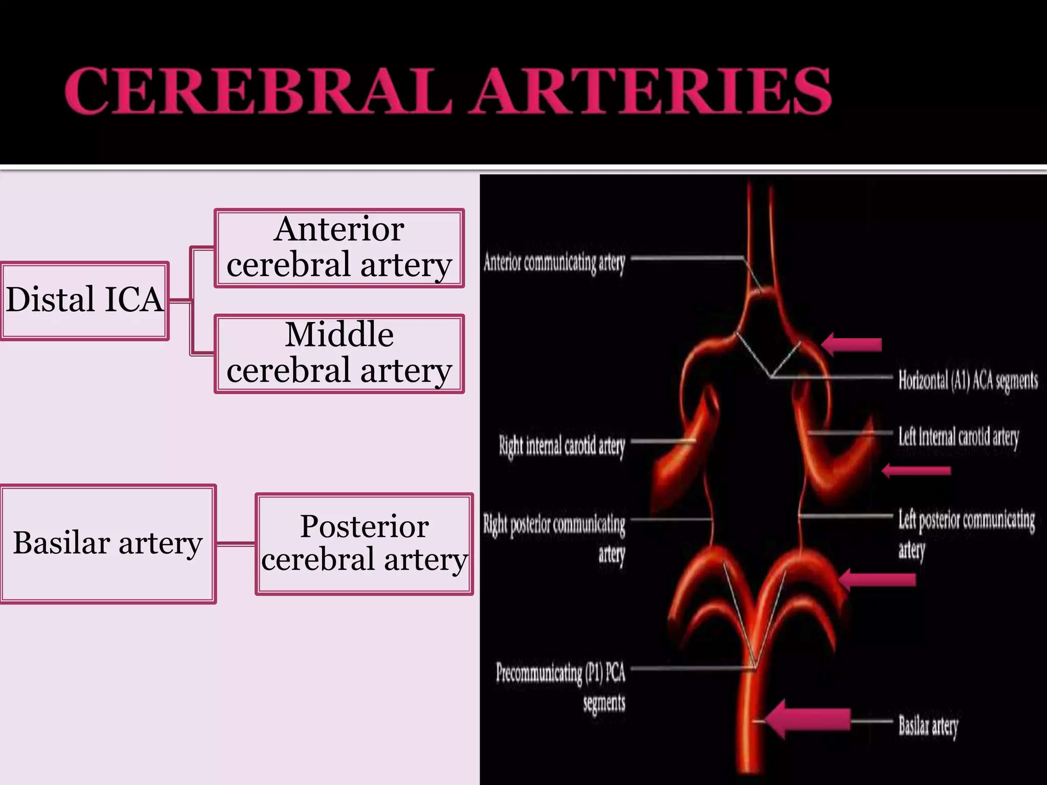 Distal ICA
Anterior
cerebral artery
Middle
cerebral artery
Basilar artery
Posterior
cerebral artery
 