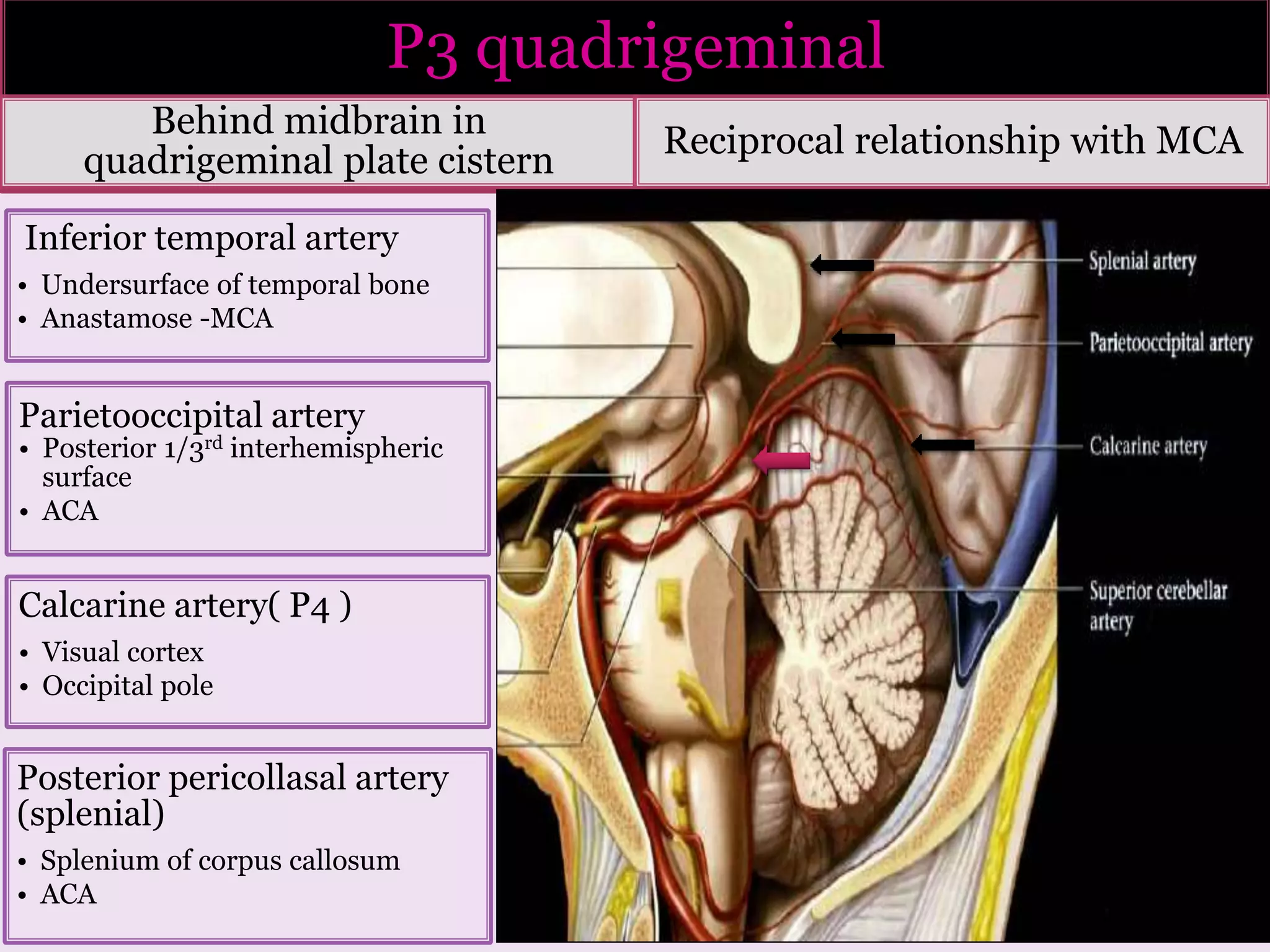 P3 quadrigeminal
Behind midbrain in
quadrigeminal plate cistern
Reciprocal relationship with MCA
Inferior temporal artery
• Undersurface of temporal bone
• Anastamose -MCA
Parietooccipital artery
• Posterior 1/3rd interhemispheric
surface
• ACA
Calcarine artery( P4 )
• Visual cortex
• Occipital pole
Posterior pericollasal artery
(splenial)
• Splenium of corpus callosum
• ACA
 