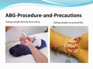 Arterial Blood Gases (2) their medical and .pptx
