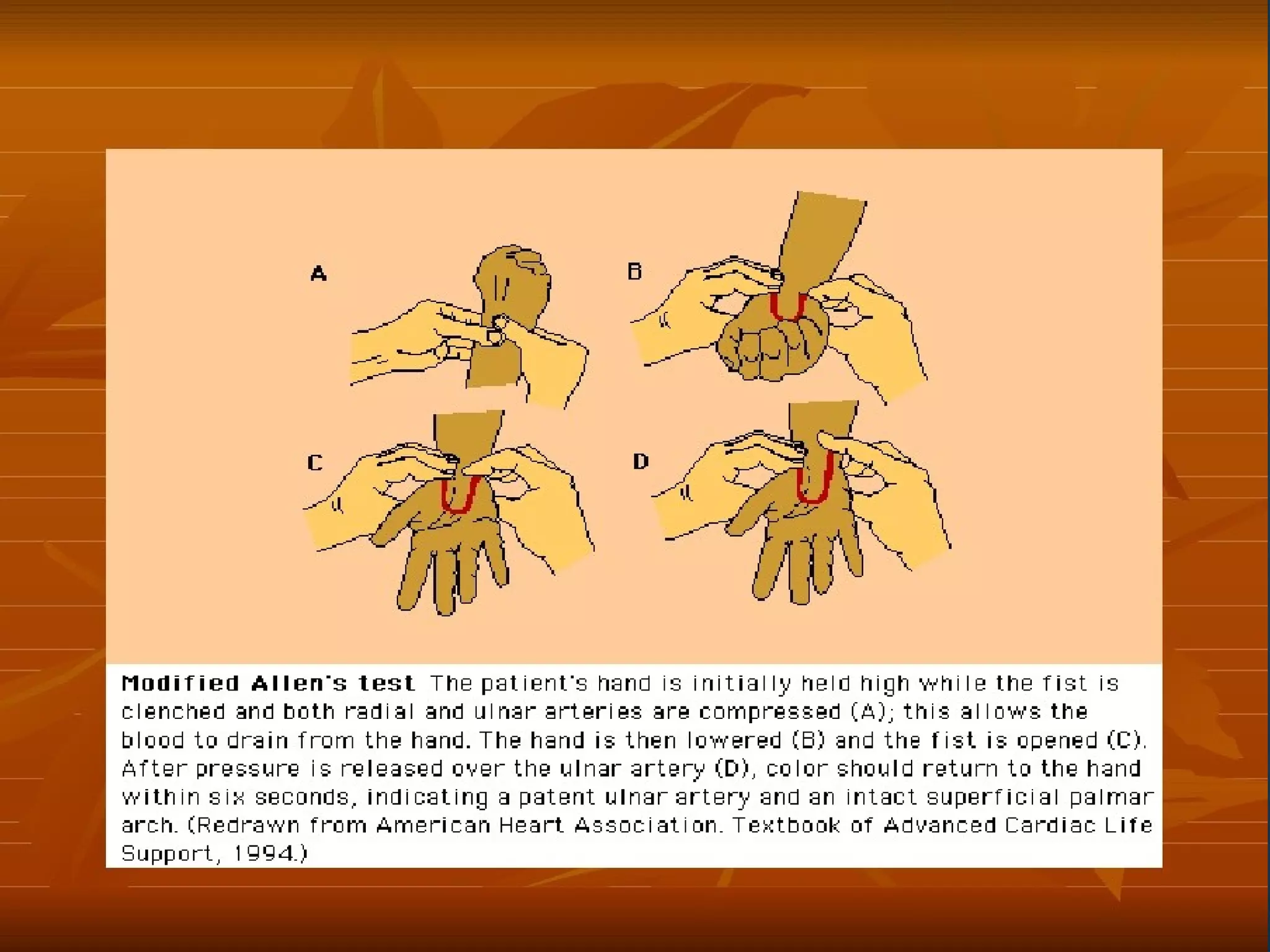 Allentestfor
Allentestforcollateralflow:
collateralflow:
 