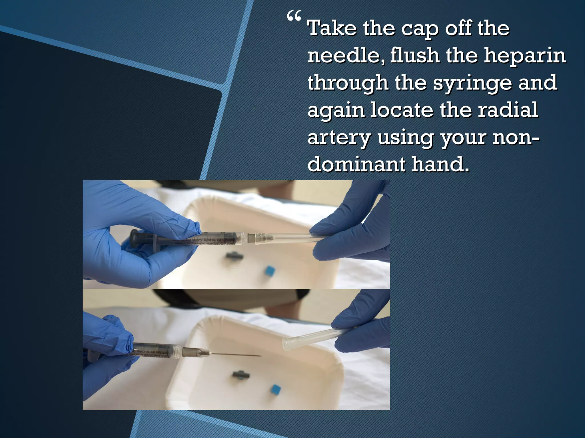 Take the cap off theTake the cap off the
needle, flush the heparinneedle, flush the heparin
through the syringe andthrough the syringe and
again locate the radialagain locate the radial
artery using your non-artery using your non-
dominant hand.dominant hand.
 