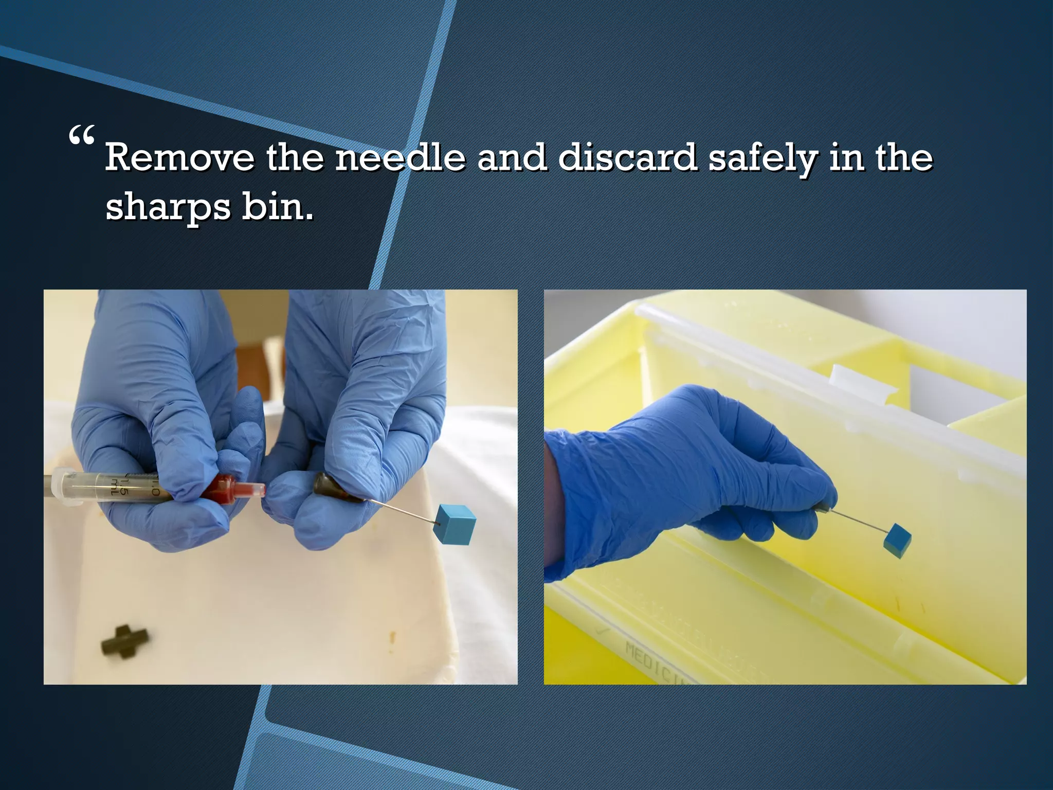 Remove the needle and discard safely in theRemove the needle and discard safely in the
sharps bin.sharps bin.
 