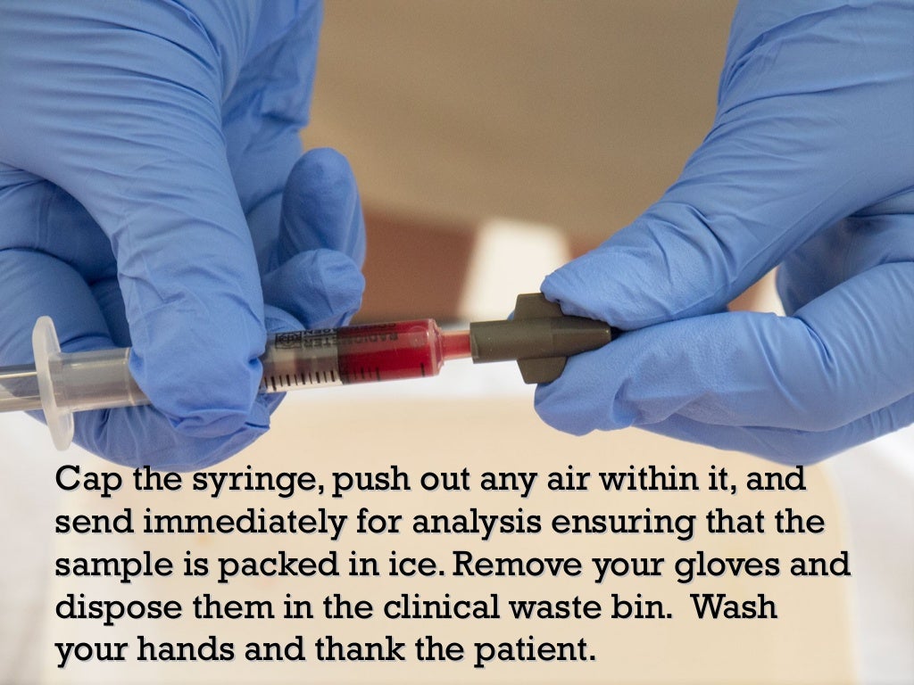 Arterial Blood Bas (ABG) Procedure and Interpretation