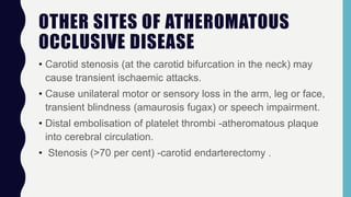 OTHER SITES OF ATHEROMATOUS
OCCLUSIVE DISEASE
• Carotid stenosis (at the carotid bifurcation in the neck) may
cause transient ischaemic attacks.
• Cause unilateral motor or sensory loss in the arm, leg or face,
transient blindness (amaurosis fugax) or speech impairment.
• Distal embolisation of platelet thrombi -atheromatous plaque
into cerebral circulation.
• Stenosis (>70 per cent) -carotid endarterectomy .
 