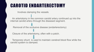 CAROTID ENDARTERECTOMY
Involves clamping the vessels
An arteriotomy in the common carotid artery continued up into the
internal carotid artery through the diseased segment.
Removal of the occlusive disease (endarterectomy)
Closure of the arteriotomy, often with a patch.
Temporary shunt is used to maintain cerebral blood flow while the
carotid system is clamped.
 