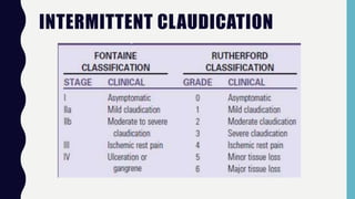 INTERMITTENT CLAUDICATION
 