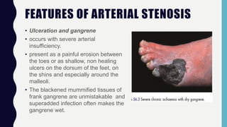 FEATURES OF ARTERIAL STENOSIS
• Ulceration and gangrene
• occurs with severe arterial
insufficiency.
• present as a painful erosion between
the toes or as shallow, non healing
ulcers on the dorsum of the feet, on
the shins and especially around the
malleoli.
• The blackened mummified tissues of
frank gangrene are unmistakable and
superadded infection often makes the
gangrene wet.
 