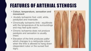 FEATURES OF ARTERIAL STENOSIS
• Colour, temperature, sensation and
movement
• Acutely ischaemic foot -cold, white,
paralysed and insensate.
• Chronically ischaemic limb - equilibrate
with the temperature of its surroundings
and may feel quite warm .
• Chronic ischaemia does not produce
paralysis and sensation is usually
intact.
• Elevation of the limb produces pallor
which changes to a red/purple colour
when the limb is allowed to hang down
(dependent rubor or the sunset foot
sign).
 