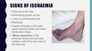 SIGNS OF ISCHAEMIA
• Thinning of the skin
• Diminished growth of hair
• Loss of subcutaneous fat
• Shininess
• Trophic changes in the nails
which become brittle and show
transverse ridges
• Minor ulceration in the
pressure areas such as heel,
malleoli, ball of the foot, tips of
the toes etc.
 