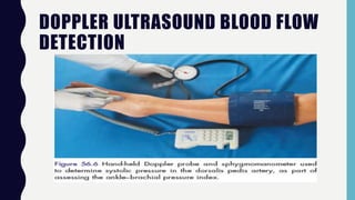 DOPPLER ULTRASOUND BLOOD FLOW
DETECTION
 