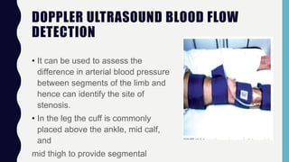 DOPPLER ULTRASOUND BLOOD FLOW
DETECTION
• It can be used to assess the
difference in arterial blood pressure
between segments of the limb and
hence can identify the site of
stenosis.
• In the leg the cuff is commonly
placed above the ankle, mid calf,
and
mid thigh to provide segmental
 