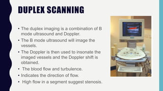 DUPLEX SCANNING
• The duplex imaging is a combination of B
mode ultrasound and Doppler.
• The B mode ultrasound will image the
vessels.
• The Doppler is then used to insonate the
imaged vessels and the Doppler shift is
obtained.
• The blood flow and turbulence.
• Indicates the direction of flow.
• High flow in a segment suggest stenosis.
 
