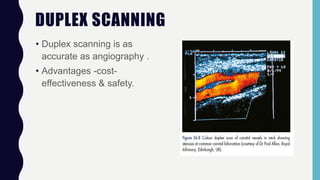 DUPLEX SCANNING
• Duplex scanning is as
accurate as angiography .
• Advantages -cost-
effectiveness & safety.
 