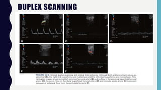 DUPLEX SCANNING
 