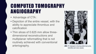 COMPUTED TOMOGRAPHY
ANGIOGRAPHY
• Advantage of CTA :
• Depiction of the entire vessel, with the
ability to appreciate thrombus and
calcification
• Thin slices of 0.625 mm allow three-
dimensional reconstructions and
multiplanar reformatting that is not
routinely achieved with conventional
arteriography.
 